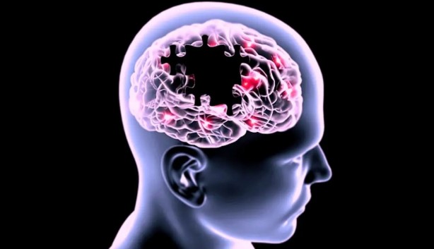 Foto - Dikkat! Bu beslenme tarzı, Alzheimer'ı hızlandırıyor