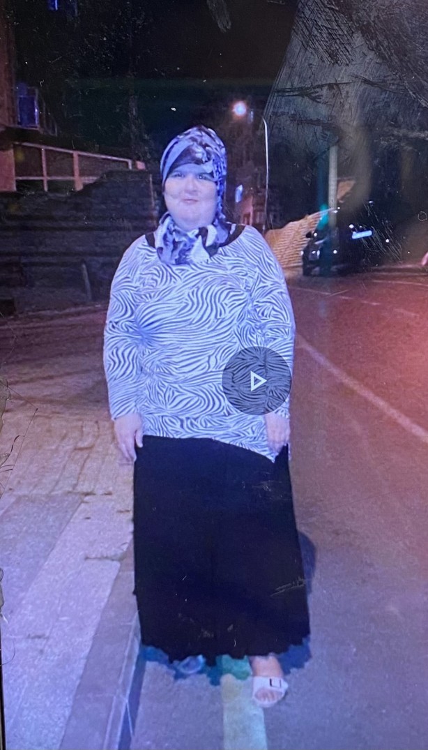 Foto - Dikkat bu olay herkesin başına gelebilir ‘Ben yandım kimse yanmasın’