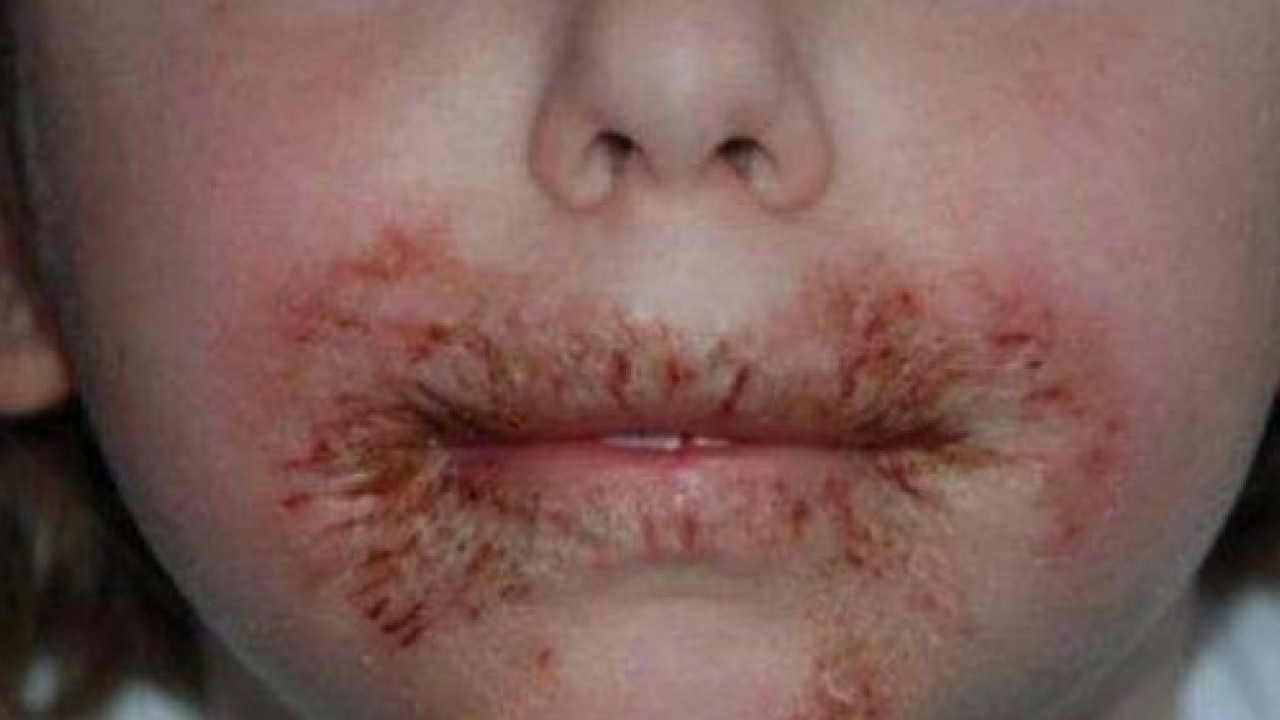 Foto - Dikkat etmenizde fayda var! Islak mendildeki büyük tehlike açıklandı