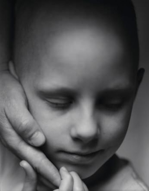 Foto - Dikkat! İşte çocuklarda kanser belirtileri...