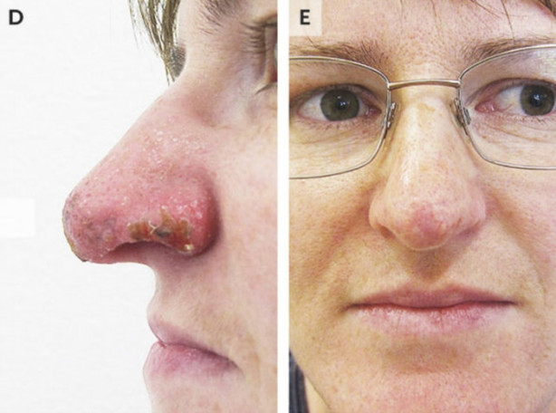 Foto - Dikkat size de olabilir! Burnu çürüdü!