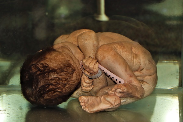 Foto - Dikkatli bakın! Sizce bu aletler ne için kullanılıyor? 