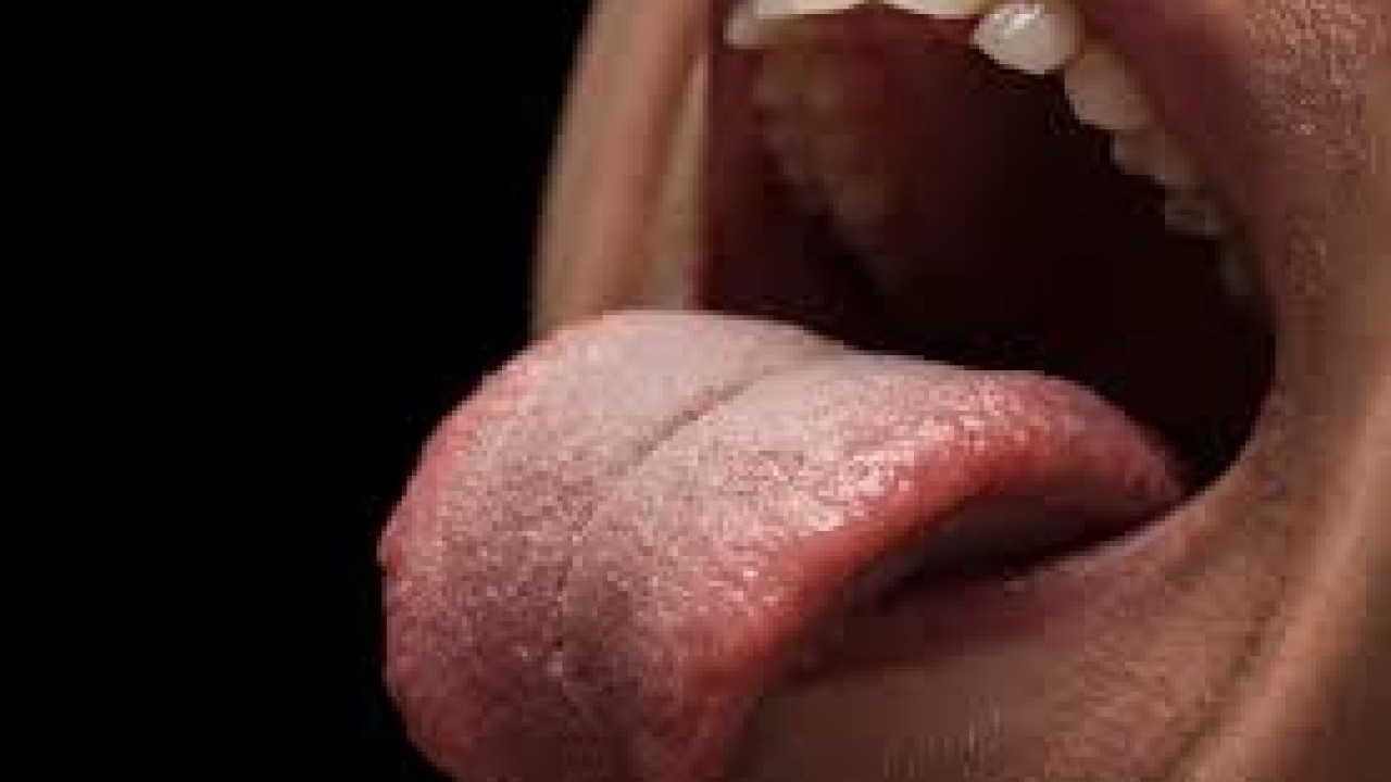 Dilinde ağrı hissetti ama önemsemedi! Bakın hangi hastalığın habercisiymiş