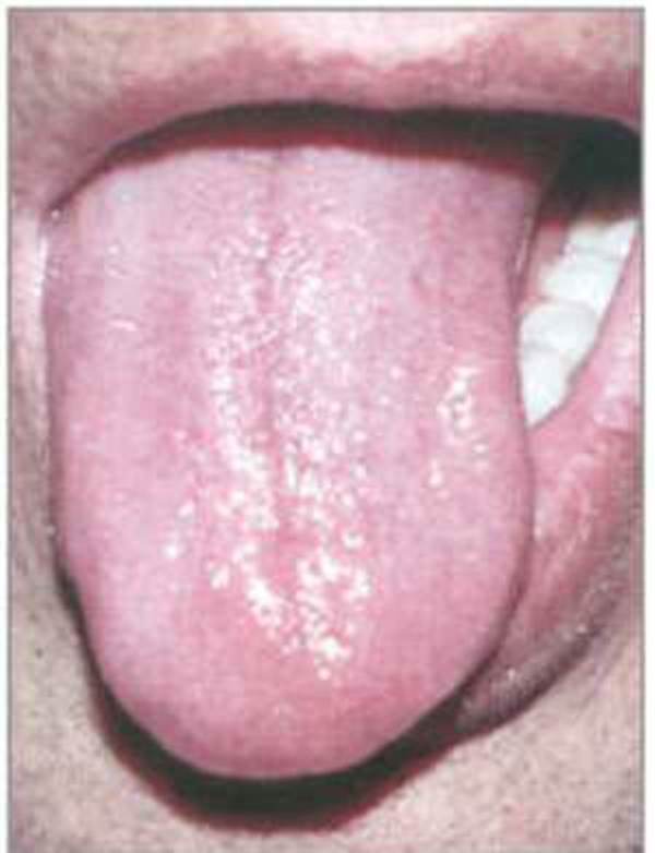 Foto - Dilinize bakarak hastalığınızı öğrenin!