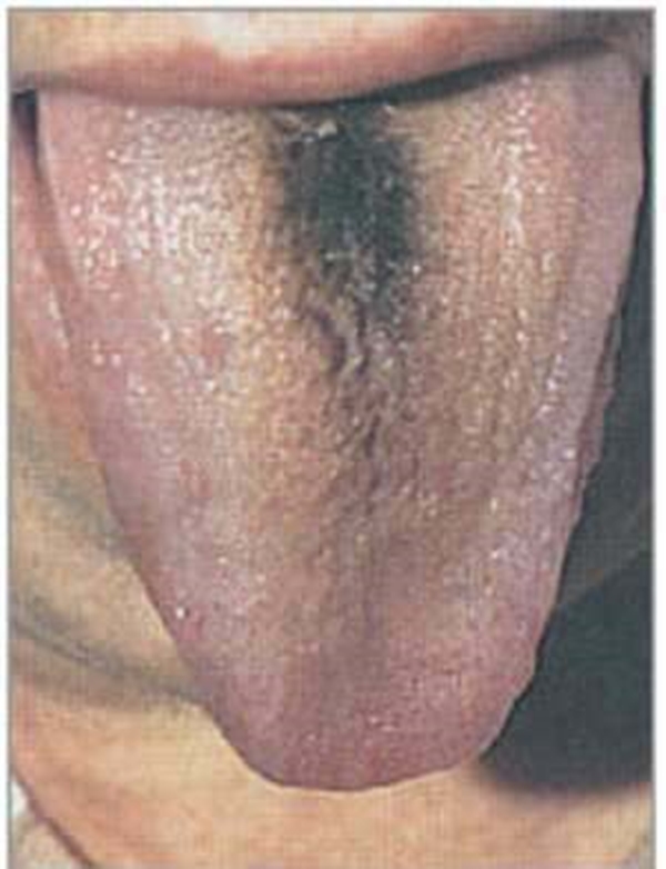 Foto - Dilinize bakarak hastalığınızı öğrenin!