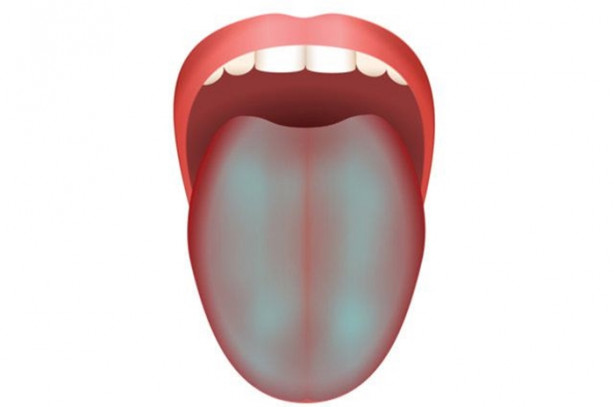 Foto - Dilinizin rengi hastalıkları ele veriyor!