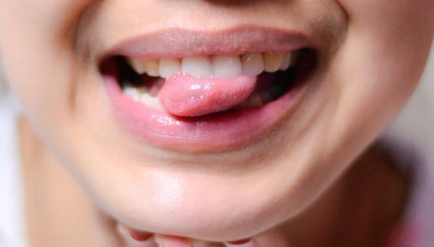 Foto - Dilinizin rengi hastalıkları ele veriyor!