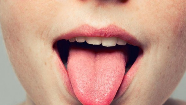 Dilinizin rengi hastalıkları ele veriyor!