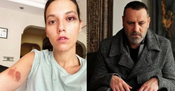 Foto - Dinlene dinlene dövüyorlarmış! Yine seküler hayat, yine kadına dayak