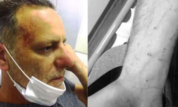 Foto - Dinlene dinlene dövüyorlarmış! Yine seküler hayat, yine kadına dayak