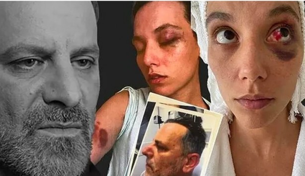 Foto - Dinlene dinlene dövüyorlarmış! Yine seküler hayat, yine kadına dayak