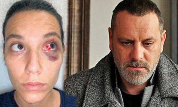 Foto - Dinlene dinlene dövüyorlarmış! Yine seküler hayat, yine kadına dayak