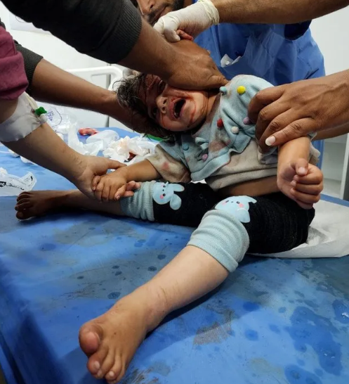 Foto - Diri diri yaktılar! ABD ve Almanya’dan skandal açıklamalar