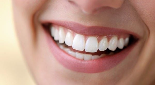 Foto - Diş beyazlatanlar dikkat! Karartıyor...