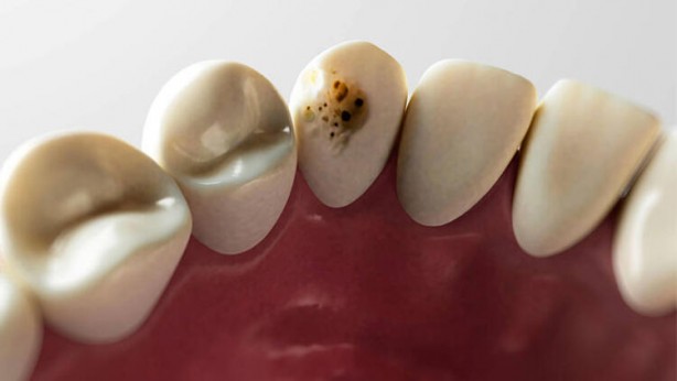 Diş fırçasını su ile ıslatanlar bu habere dikkat! Bundan sonra...