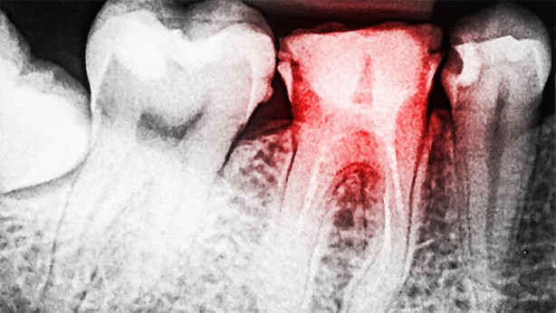 Foto - Diş fırçasını su ile ıslatanlar bu habere dikkat! Bundan sonra...