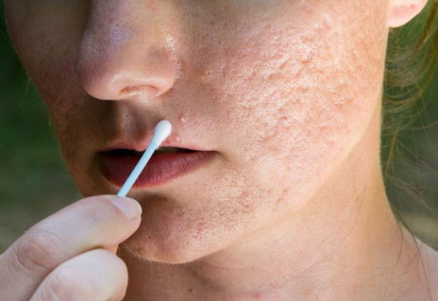 Foto - Diş macununu tırnağınıza sürerseniz...