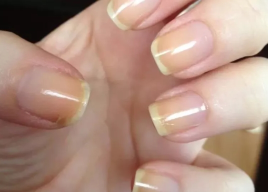 Foto - Diş macununuzu tırnağınıza sürerseniz bakın ne oluyor!