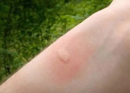 Diş macununuzu tırnağınıza sürerseniz bakın ne oluyor!