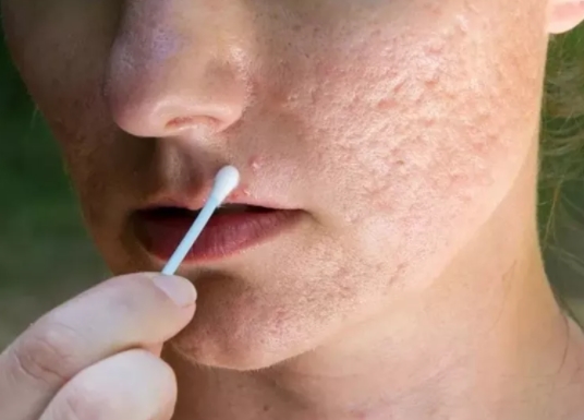 Foto - Diş macununuzu tırnağınıza sürerseniz bakın ne oluyor!