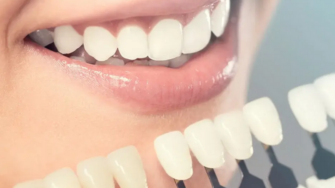 Foto - Diş rengi sağlık hakkında ipuçları veriyor! O zıkkımdan uzak durmalısınız! Ayrıntılara dikkat