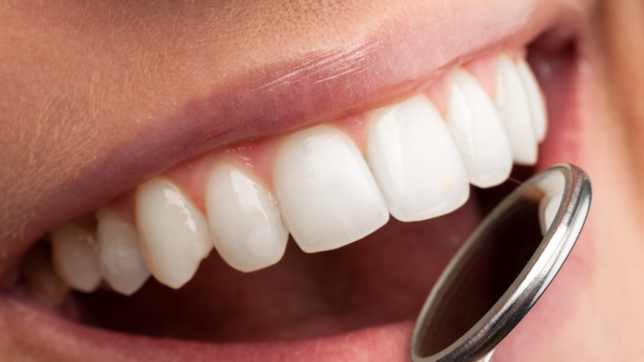 Foto - Diş rengi sağlık hakkında ipuçları veriyor! O zıkkımdan uzak durmalısınız! Ayrıntılara dikkat
