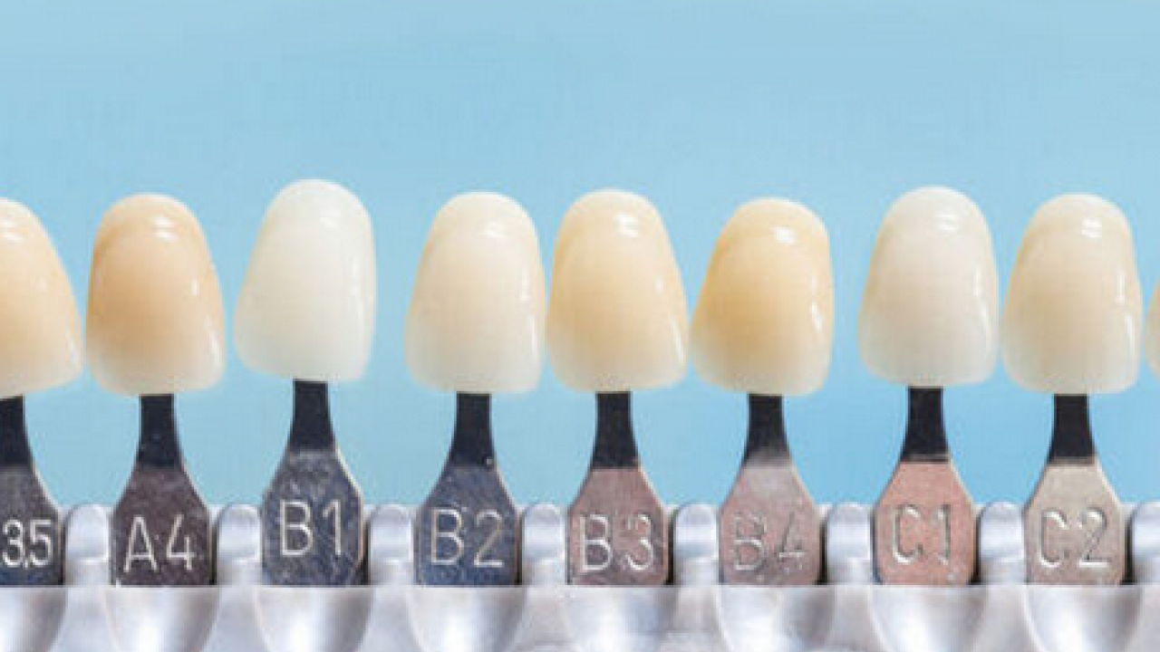 Foto - Diş rengi sağlık hakkında ipuçları veriyor! O zıkkımdan uzak durmalısınız! Ayrıntılara dikkat