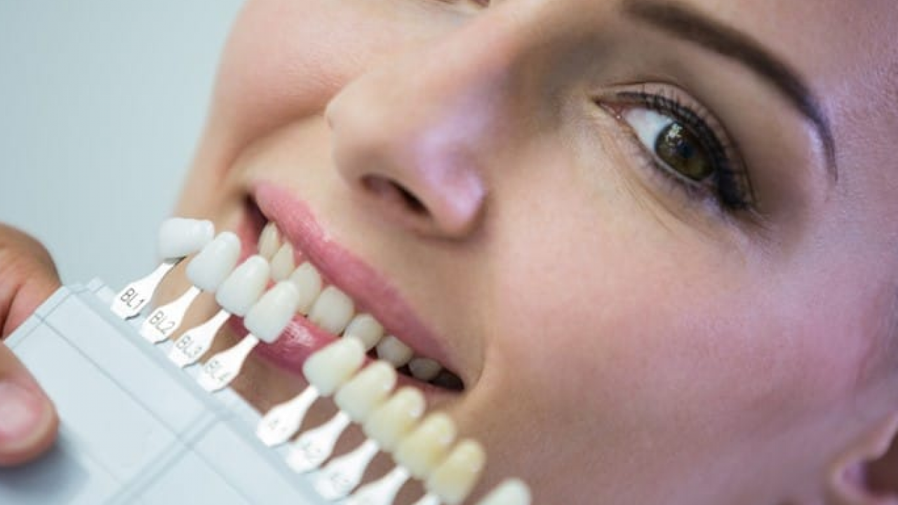 Foto - Diş rengi sağlık hakkında ipuçları veriyor! O zıkkımdan uzak durmalısınız! Ayrıntılara dikkat
