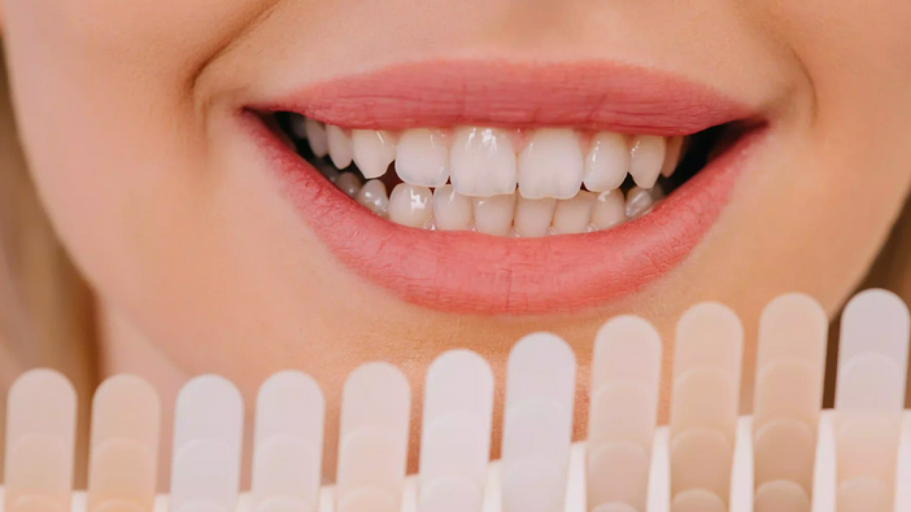 Diş rengi sağlık hakkında ipuçları veriyor! O zıkkımdan uzak durmalısınız! Ayrıntılara dikkat