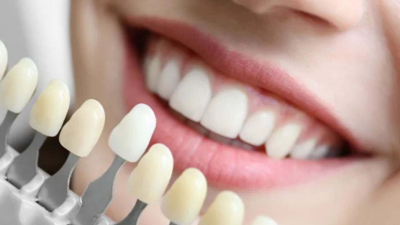 Foto - Diş rengi sağlık hakkında ipuçları veriyor! O zıkkımdan uzak durmalısınız! Ayrıntılara dikkat