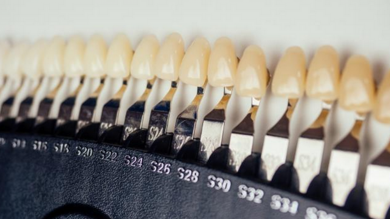 Foto - Diş rengi sağlık hakkında ipuçları veriyor! O zıkkımdan uzak durmalısınız! Ayrıntılara dikkat