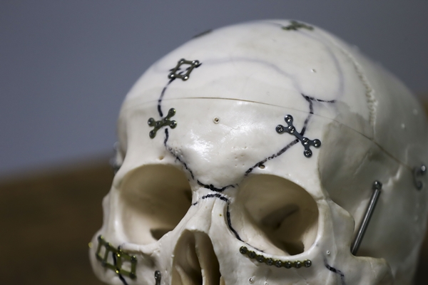 Foto - Dışa bağımlılık artık sona erdi... Türkiye'de geliştirildi