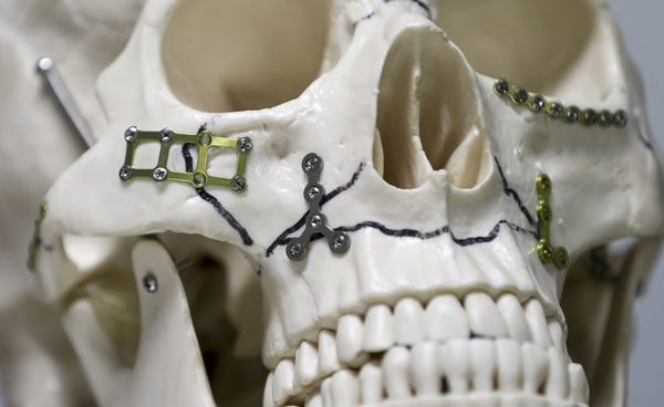 Foto - Dışa bağımlılık artık sona erdi... Türkiye'de geliştirildi