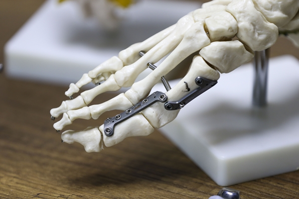 Foto - Dışa bağımlılık artık sona erdi... Türkiye'de geliştirildi