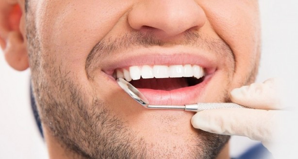 Foto - Dişleri doğal yollarla beyazlatmak için teknikler