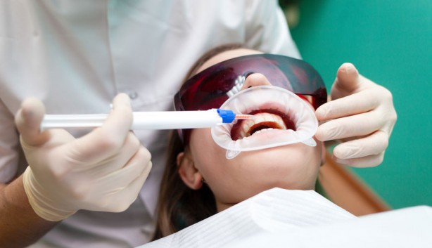 Foto - Dişleri doğal yollarla beyazlatmak için teknikler