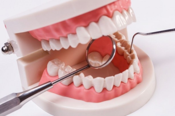 Foto - Dişleri inci gibi yapan besinler