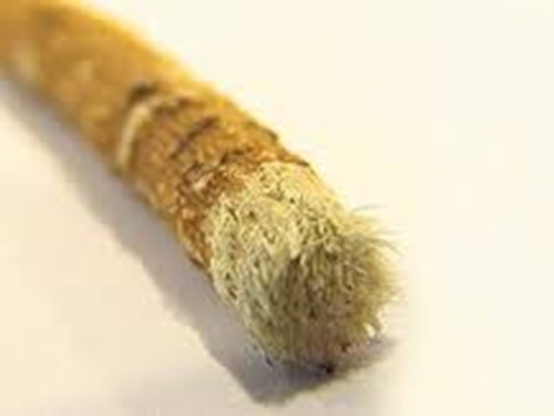 Foto - Dişlerinizden memnun değilseniz...