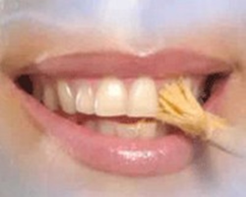 Foto - Dişlerinizden memnun değilseniz...