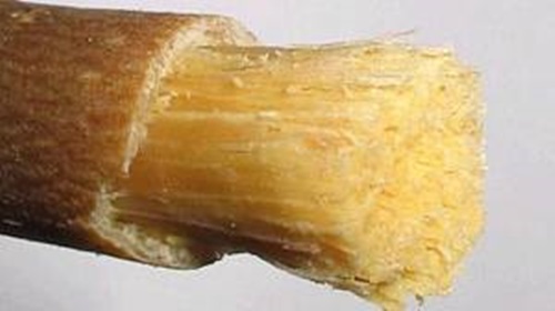 Foto - Dişlerinizden memnun değilseniz...