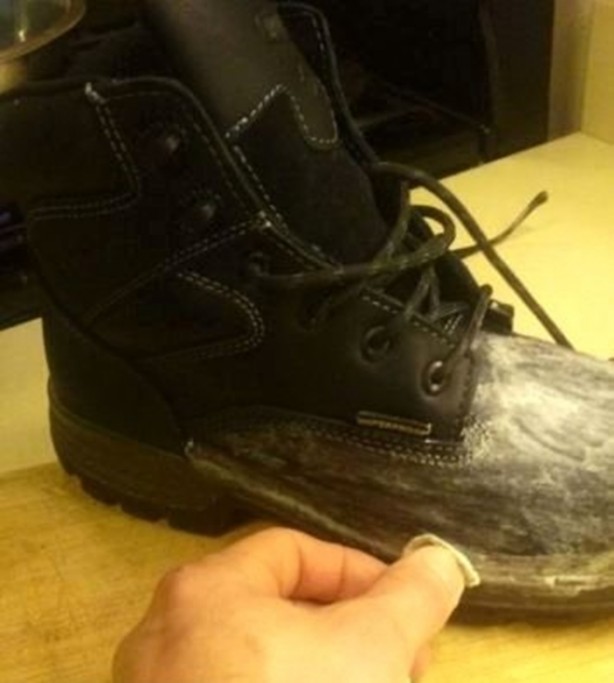 Foto - Dişlerinizi alüminyum folyo ile kaplarsanız ne olur?