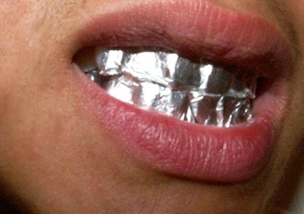 Foto - Dişlerinizi alüminyum folyo ile kaplarsanız ne olur?