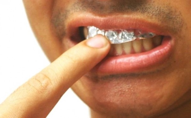 Foto - Dişlerinizi alüminyum folyo ile kaplarsanız ne olur?