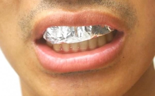 Foto - Dişlerinizi alüminyum folyo ile kaplarsanız ne olur?