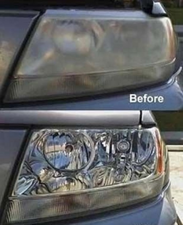 Foto - Dişlerinizi alüminyum folyo ile kaplarsanız ne olur?