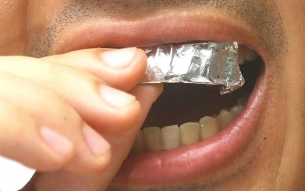 Foto - Dişlerinizi alüminyum folyo ile kaplarsanız ne olur?