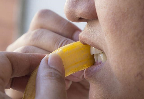 Foto - Dişlerinizi doğal yollarla beyazlatmak istiyorsanız...