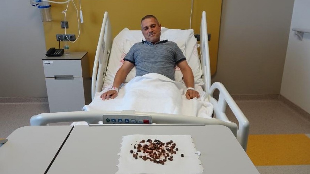 Foto - Doktorlar bile şaştı kaldı! Bakın böbreğinden kaç tane taş çıktı