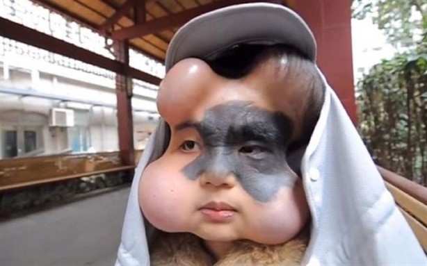 Doktorlar genç kızı bu hale getirdi