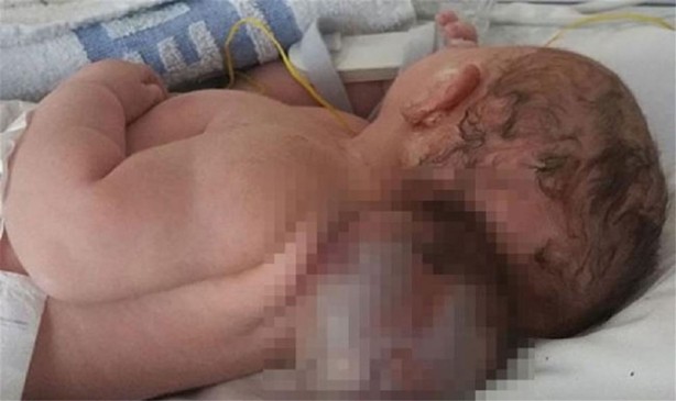 Doktorlar hayrete düştü!